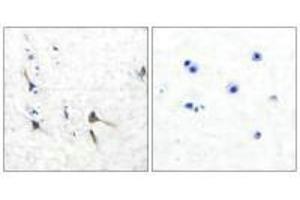 Immunohistochemical analysis of paraffin-embedded human brain tissue using Potassium Channel Kv3. (KCNC2 anticorps)