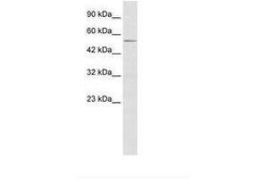 Image no. 1 for anti-ZFP91 Zinc Finger Protein (ZFP91) (AA 231-280) antibody (ABIN203197) (ZFP91 anticorps  (AA 231-280))