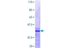 Image no. 1 for V-Ets erythroblastosis Virus E26 Oncogene Homolog 1 (Avian) (ETS1) (AA 173-272) protein (GST tag) (ABIN1353169)