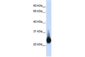 WB Suggested Anti-CLDN5 Antibody Titration:  0. (Claudin 5 anticorps  (C-Term))