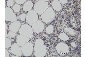 Immunoperoxidase of monoclonal antibody to MPG on formalin-fixed paraffin-embedded human lymph node. (MPG anticorps  (AA 1-90))