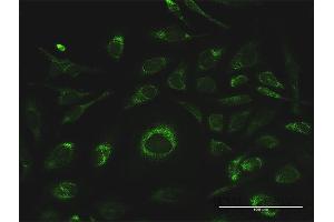 Immunofluorescence of purified MaxPab antibody to GSTK1 on HeLa cell. (GSTK1 anticorps  (AA 1-226))