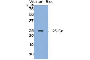 Western Blotting (WB) image for anti-Alcohol Dehydrogenase 1 (Class I) (ADH1) (AA 25-228) antibody (ABIN1857916) (ADH1 anticorps  (AA 25-228))