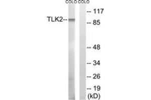 Western blot analysis of extracts from COLO cells, using TLK2 Antibody. (TLK2 anticorps  (AA 191-240))