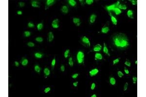 Immunofluorescence of monoclonal antibody to MEOX2 on HeLa cell. (MEOX2 anticorps  (AA 1-303))