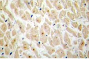 Immunohistochemistry (IHC) analyzes of MAPKAPK-2 antibody in paraffin-embedded human heart tissue. (MAPKAP Kinase 2 anticorps)