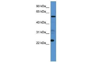 Western Blot showing CPNE9 antibody used at a concentration of 1-2 ug/ml to detect its target protein. (CPNE9 anticorps  (C-Term))