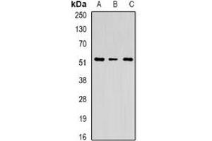 Western blot analysis of Chitotriosidase expression in U251 (A), HEK293T (B), mouse spleen (C) whole cell lysates. (Chitotriosidase 1 anticorps)