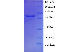 SDS-PAGE (SDS) image for Mucin 2, Oligomeric Mucus/gel-Forming (MUC2) (AA 36-240) protein (His-SUMO Tag) (ABIN5709977)