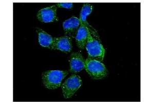 IF analysis of RASA1 using anti-RASA1 antibody (ABIN3043368).