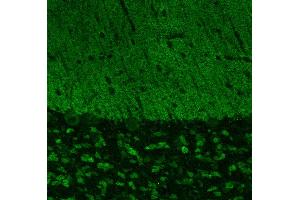 Indirect immunostaining of PFA fixed cerebellum sections (dilution 1 : 500).