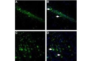 Expression of NLGN1 in rat hippocampus and cortex - Immunohistochemical staining of free floating frozen section of rat hippocampal CA1 region (A, B) and rat parietal cortex (C, D) using Anti-Neuroligin 1 (extracellular) Antibody (ABIN7043361, ABIN7044680 and ABIN7044681), (1:300).