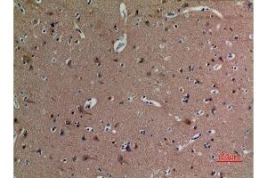 Immunohistochemistry (IHC) analysis of paraffin-embedded Human Brain, antibody was diluted at 1:100.