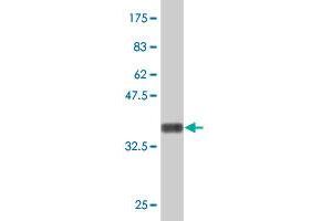 Western Blot detection against Immunogen (37.