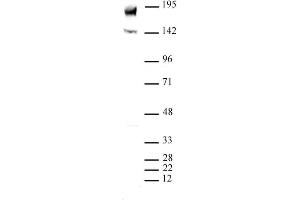 PBRM1 (pAb) tested by Western blot. (Polybromo 1 anticorps  (N-Term))