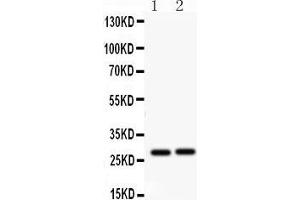 Western Blotting (WB) image for anti-Insulin-Like Growth Factor Binding Protein 1 (IGFBPI) (AA 177-207), (C-Term) antibody (ABIN3042732) (IGFBPI anticorps  (C-Term))