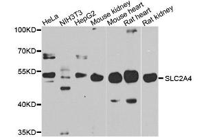 Western blot analysis of extracts of various cell lines, using SLC2A4 antibody. (GLUT4 anticorps  (C-Term))
