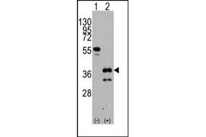 Image no. 1 for anti-Zic Family Member 4 (ZIC4) (C-Term) antibody (ABIN357859) (ZIC4 anticorps  (C-Term))