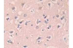 Detection of IL1R1 in Human Cerebrum Tissue using Polyclonal Antibody to Interleukin 1 Receptor Type I (IL1R1)