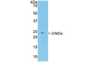 Detection of Recombinant PCDHb2, Mouse using Polyclonal Antibody to Protocadherin Beta 2 (PCDHb2) (PCDHb2 anticorps  (AA 79-253))