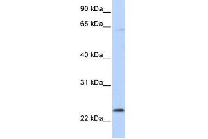 CHAC1 antibody used at 1 ug/ml to detect target protein. (CHAC1 anticorps)