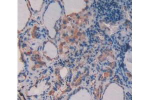 IHC-P analysis of Human Tissue, with DAB staining. (Supervillin anticorps  (AA 1617-1788))