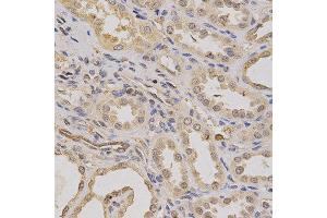 Immunohistochemistry of paraffin-embedded human kidney using ATP6AP1 antibody at dilution of 1:200 (x400 lens). (ATP6AP1 anticorps)