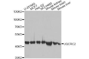 Western blot analysis of extracts of various cell lines, using UQCRC2 antibody. (UQCRC2 anticorps)