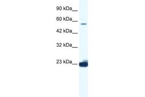 Western Blotting (WB) image for anti-DEAD (Asp-Glu-Ala-Asp) Box Polypeptide 55 (DDX55) antibody (ABIN2461357)