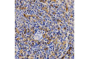 Immunohistochemistry of paraffin-embedded rat spleen using CDK20 antibody (ABIN5971446) at dilution of 1/200 (40x lens). (CCRK anticorps)