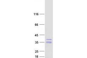 Validation with Western Blot