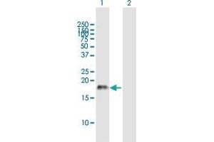 Western Blot analysis of CSF2 expression in transfected 293T cell line by CSF2 MaxPab polyclonal antibody.