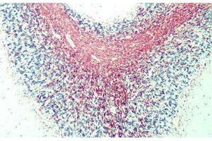 Anti-Myelin Basic Protein antibody IHC of human myelin. (MBP anticorps  (AA 82-87))