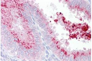 Anti-KIAA1324 antibody IHC staining of human uterus. (ELAPOR1 anticorps  (C-Term))