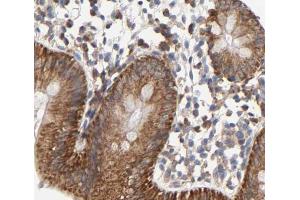Cytochrome c Antibody for IHC in human colorectal tissue (Cytochrome C anticorps)