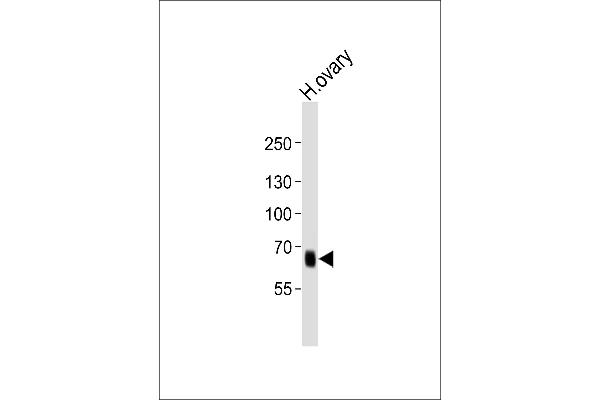 PRDM13 Antikörper  (N-Term)