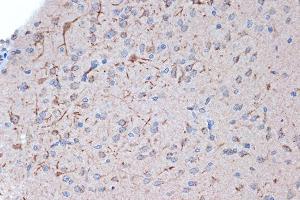 Immunohistochemistry of paraffin-embedded rat brain using Syntenin Rabbit mAb (ABIN7270680) at dilution of 1:100 (40x lens). (SDCBP anticorps)