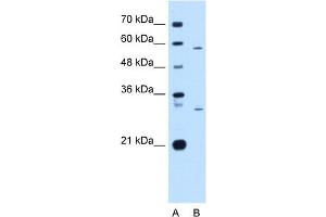 Western Blot showing CD36 antibody used at a concentration of 1-2 ug/ml to detect its target protein. (CD36 anticorps)