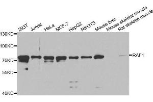 Western Blotting (WB) image for anti-V-Raf-1 Murine Leukemia Viral Oncogene Homolog 1 (RAF1) (AA 190-350) antibody (ABIN3020713) (RAF1 anticorps  (AA 190-350))