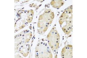 Immunohistochemistry of paraffin-embedded human stomach using HNRNPL antibody. (HNRNPL anticorps  (AA 282-589))