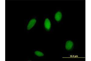 Immunofluorescence of purified MaxPab antibody to ZNF83 on HeLa cell. (ZNF83 anticorps  (AA 1-516))
