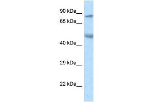 WB Suggested Anti-Zfp90 Antibody   Titration: 1. (ZNF90 anticorps  (N-Term))