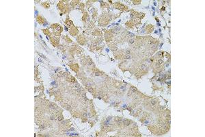 Immunohistochemistry of paraffin-embedded human stomach using BEST1 antibody (ABIN6003520) at dilution of 1/100 (40x lens). (Bestrophin 1 anticorps)