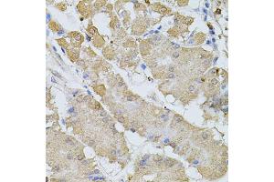 Immunohistochemistry of paraffin-embedded human stomach using BEST1 antibody (ABIN6003520) at dilution of 1/100 (40x lens).