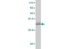 Western Blot detection against Immunogen (36. (CAMK1 anticorps  (AA 271-370))