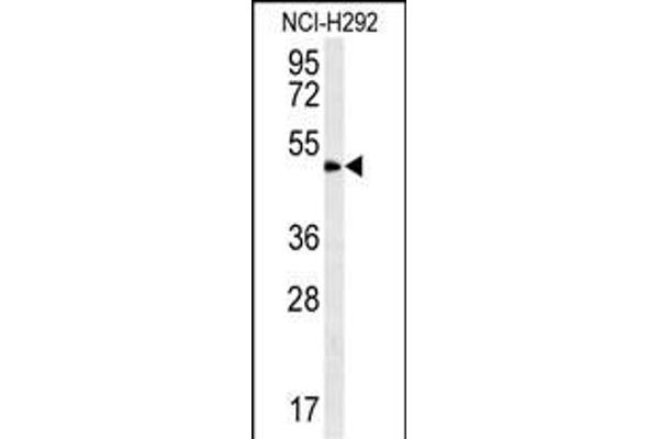 ZNF154 anticorps  (N-Term)