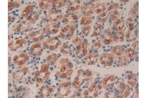 DAB staining on IHC-P; Samples: Human Stomach Tissue (Intrinsic Factor anticorps  (AA 198-413))