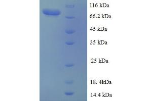 SDS-PAGE (SDS) image for Calcium-Sensing Receptor (CASR) (AA 20-612), (Extracellular) protein (GST tag) (ABIN5709205)