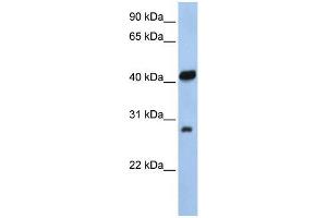 Human 721_B; WB Suggested Anti-ZFAND3 Antibody Titration: 0.