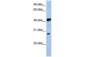 Human 721_B; WB Suggested Anti-ZFAND3 Antibody Titration: 0. (ZFAND3 anticorps  (N-Term))